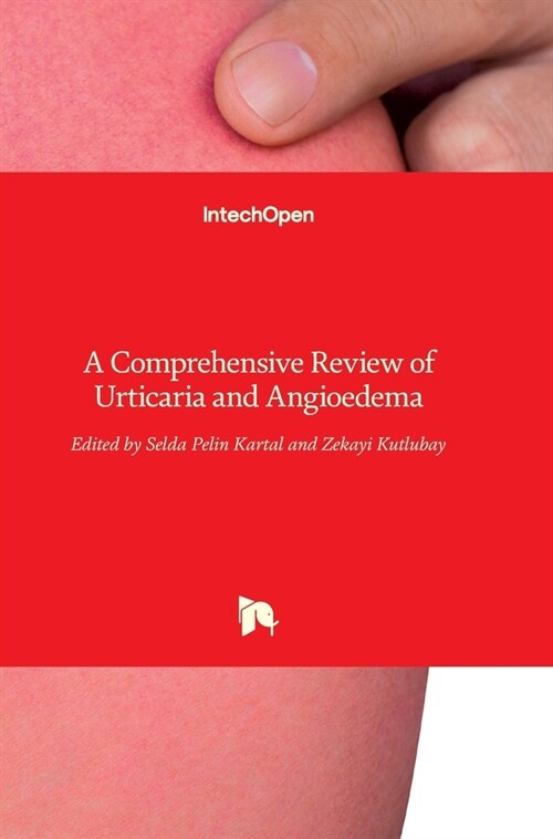 Urticaria and Angioedema : A Comprehensive Review of (Hardcover)