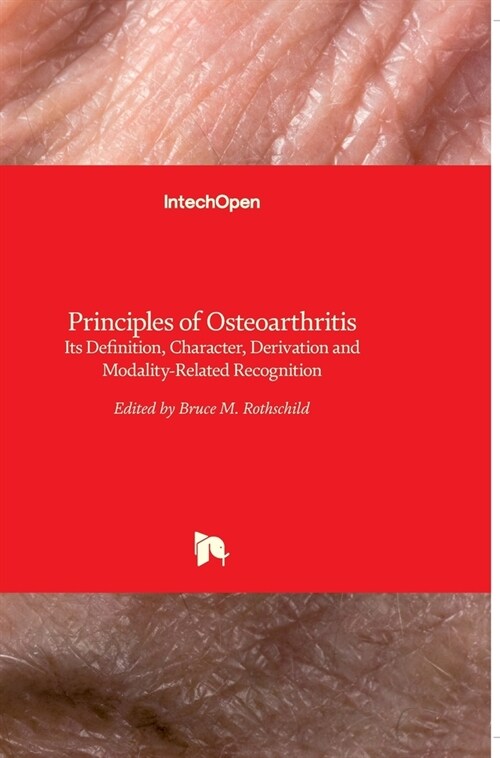 Principles of Osteoarthritis: Its Definition, Character, Derivation and Modality-Related Recognition (Hardcover)