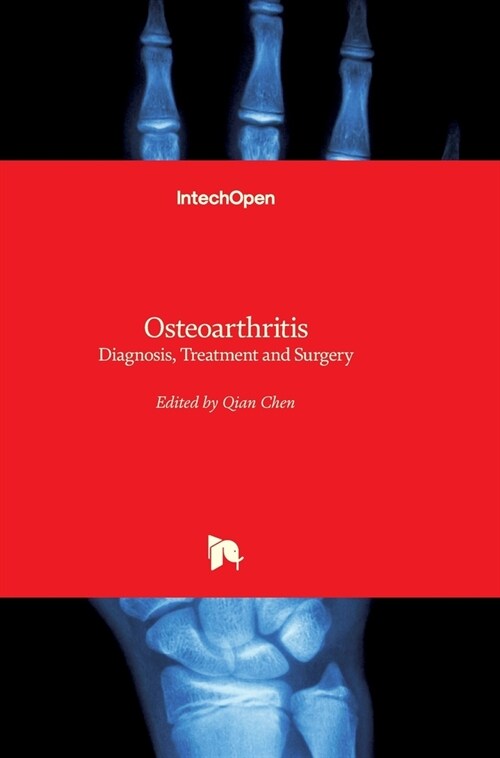 Osteoarthritis: Diagnosis, Treatment and Surgery (Hardcover)