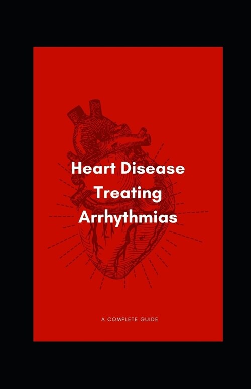 Heart Disease Treating Arrhythmias (Paperback)