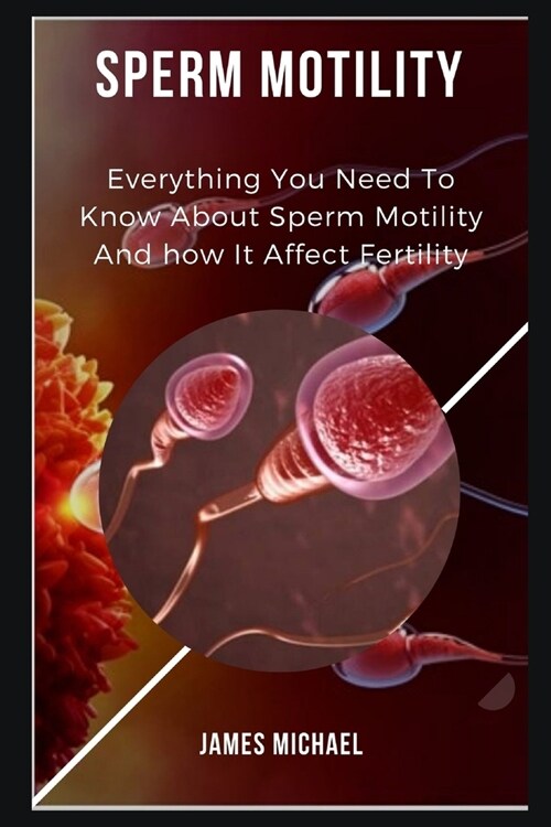 Sperm Motility: Everything You Need To Know About Sperm Motility And It Affect Fertility (Paperback)