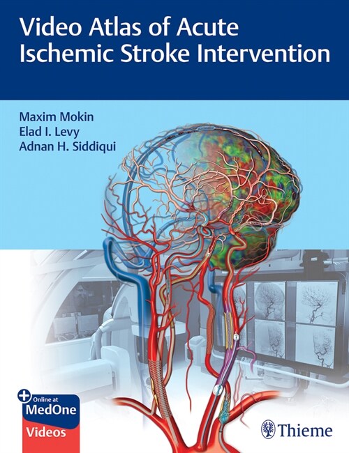 Video Atlas of Acute Ischemic Stroke Intervention (Hardcover)