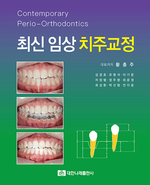 [중고] 최신 임상 치주교정