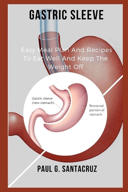 Gastric Sleeve: Easy Meal Plan And Recipes To Eat Well And Keep The Weight Off (Paperback)