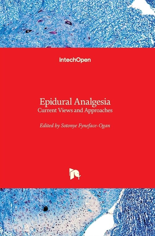 Epidural Analgesia: Current Views and Approaches (Hardcover)