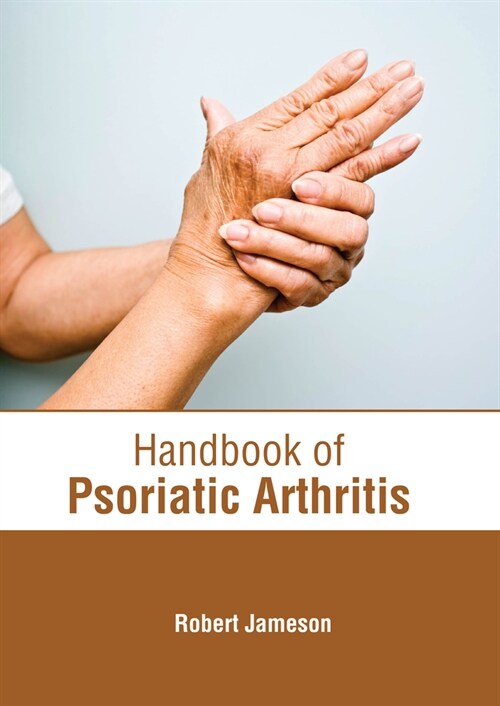 Handbook of Psoriatic Arthritis (Hardcover)