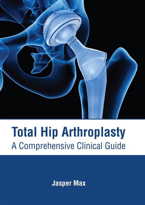 Total Hip Arthroplasty: A Comprehensive Clinical Guide (Hardcover)