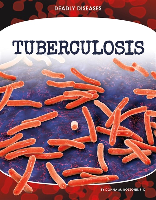 Tuberculosis (Library Binding)