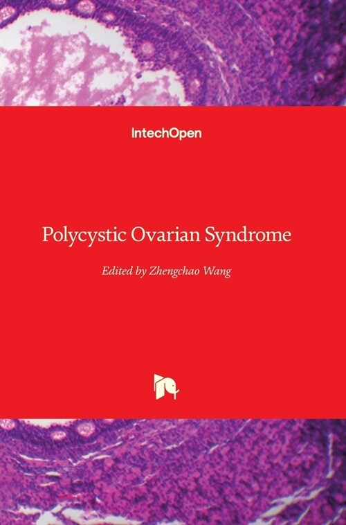 Polycystic Ovarian Syndrome (Hardcover)