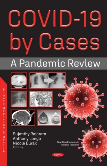 COVID-19 by Cases : A Pandemic Review (Hardcover)