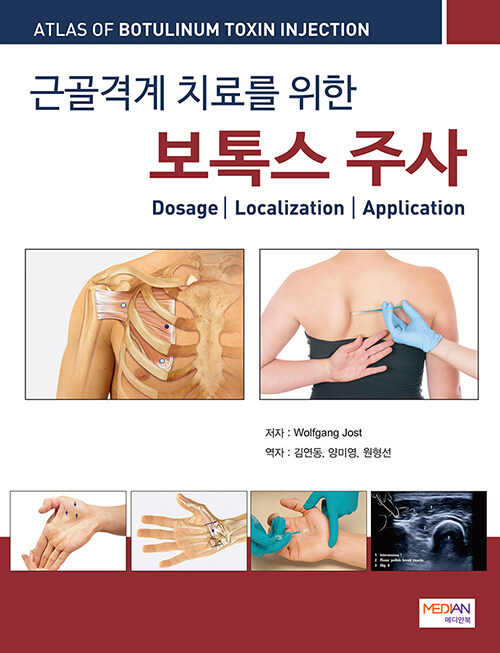 근골격계 치료를 위한 보톡스 주사