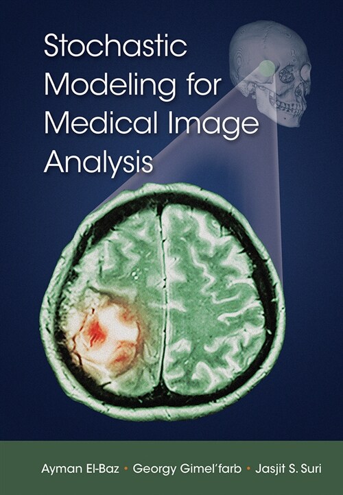 Stochastic Modeling for Medical Image Analysis (Paperback, 1)