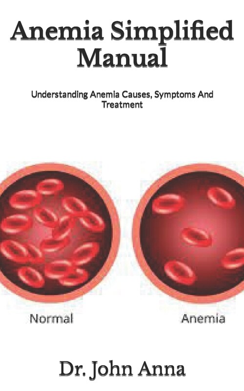 Anemia Simplified Manual : Understanding Anemia Causes, Symptoms And Treatment (Paperback)