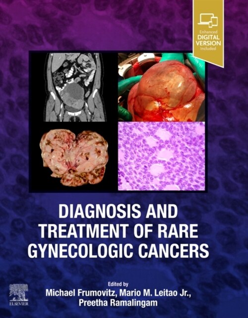 Diagnosis and Treatment of Rare Gynecologic Cancers (Hardcover)