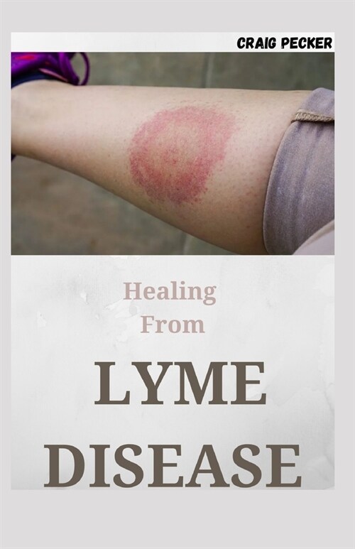 Healing From Lyme Disease: Medicine Guide to Diagnosing and Treating Tick-Borne Illness (Paperback)