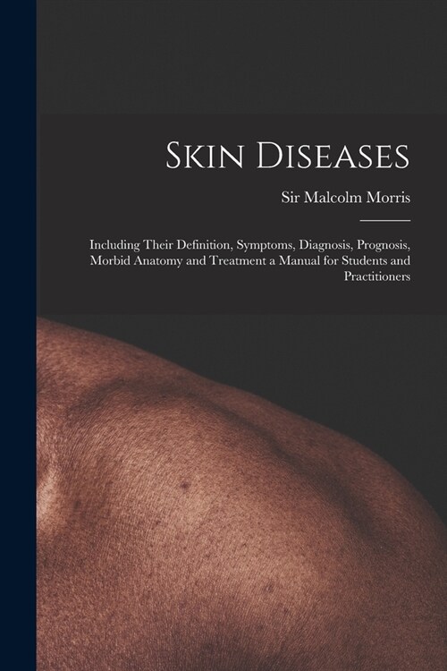 Skin Diseases [electronic Resource]: Including Their Definition, Symptoms, Diagnosis, Prognosis, Morbid Anatomy and Treatment a Manual for Students an (Paperback)