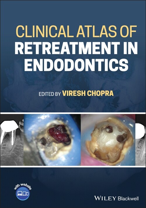 [eBook Code] Clinical Atlas of Retreatment in Endodontics (eBook Code, 1st)