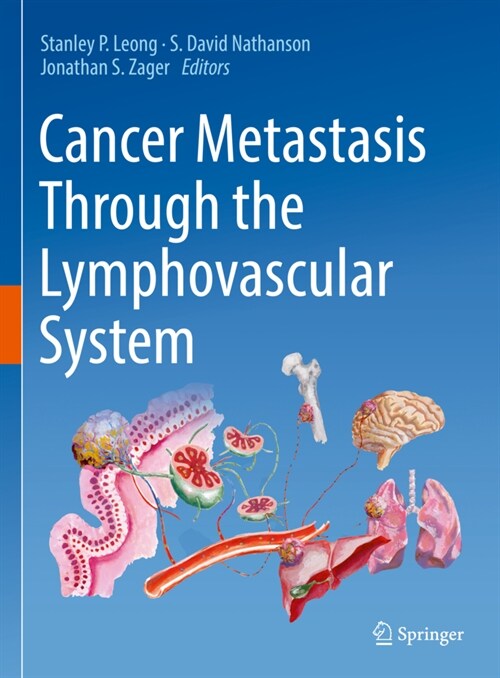 Cancer Metastasis Through the Lymphovascular System (Hardcover)