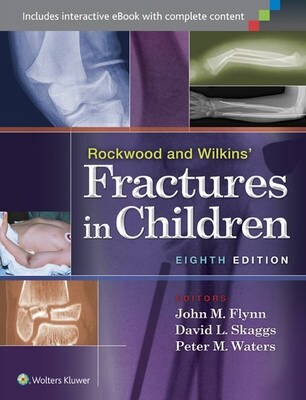 [eBook Code] Rockwood and Wilkins Fractures in Children