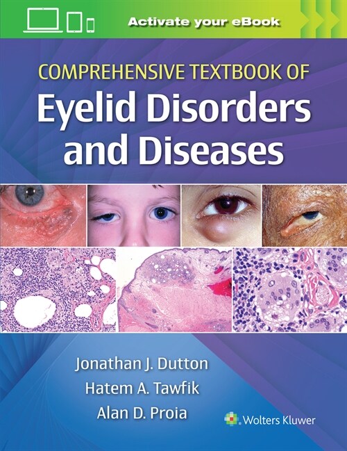 Comprehensive Textbook of Eyelid Disorders and Diseases (Hardcover)
