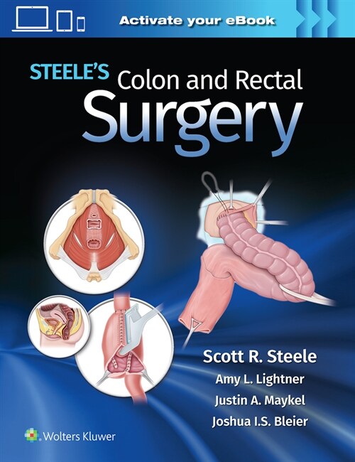 Steeles Colon and Rectal Surgery (Hardcover)