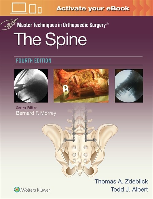 Master Techniques in Orthopaedic Surgery: The Spine (Hardcover, 4)