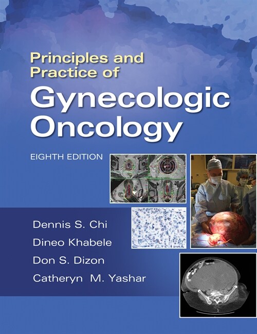 Principles and Practice of Gynecologic Oncology (Hardcover)