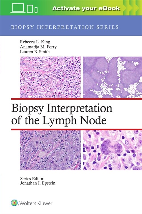 Biopsy Interpretation of the Lymph Node: Print + eBook with Multimedia (Hardcover)