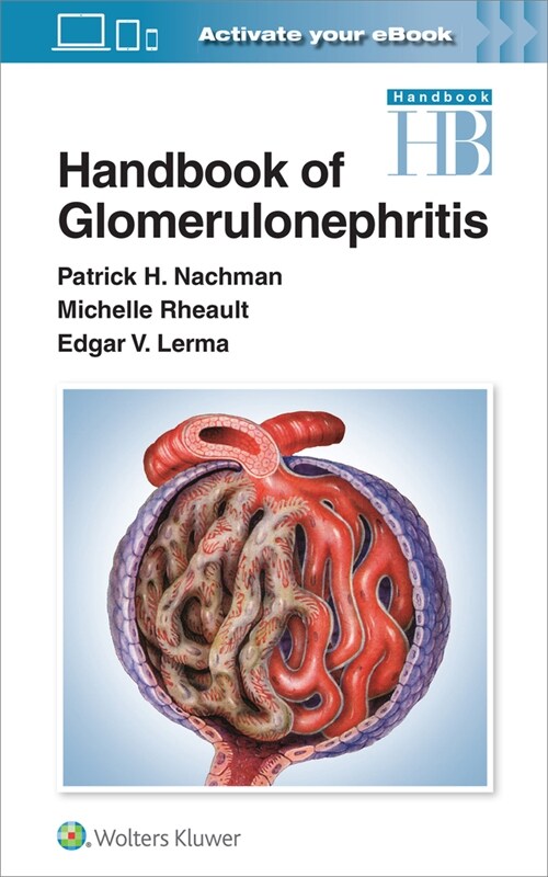 Handbook of Glomerulonephritis (Paperback)