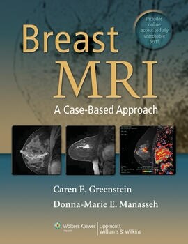 [eBook Code]Breast MRI: A Practical Approach, VST PDF