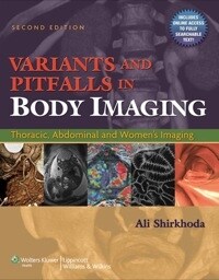 [eBook Code]Variants and Pitfalls in Body Imaging, VST PDF