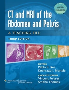 [eBook Code] CT & MRI of the Abdomen and Pelvis (LWW Teaching File Series)
