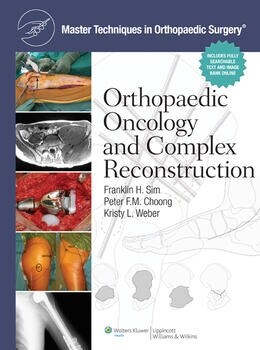 [eBook Code] Master Techniques in Orthopaedic Surgery: Orthopaedic Oncology and Complex Reconstruction (Master Techniques in Orthopaedic Surgery)