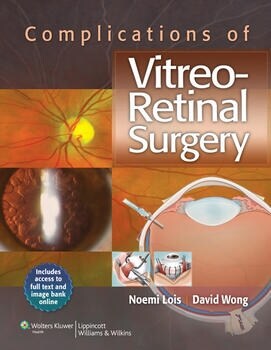 [eBook Code] Complications of Vitreo-Retinal Surgery
