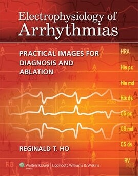 [eBook Code]VitalSource e-Book for Electrophysiology of Arrhythmias