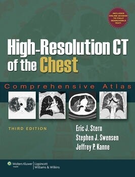 [eBook Code]VitalSource E-book for High-Resolution CT of the Chest