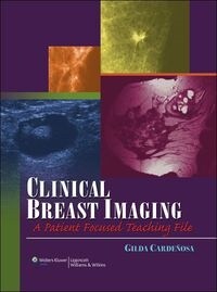 [eBook Code]VitalSource ebook for Clinical Breast Imaging, VST XML