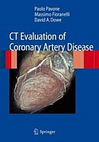 CT Evaluation of Coronary Artery Disease (Paperback)