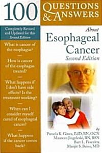 100 Questions & Answers about Esophageal Cancer (Paperback, 2, Revised, Update)