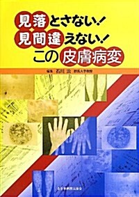 見落とさない! 見間違えない! この皮膚病變 (單行本)