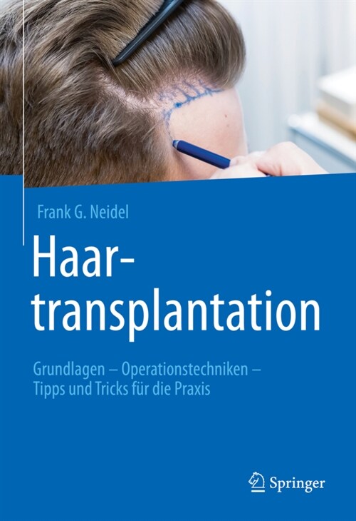 Haartransplantation: Grundlagen - Operationstechniken - Tipps Und Tricks F? Die Praxis (Hardcover, 1. Aufl. 2022)