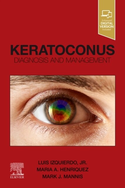 Keratoconus: Diagnosis and Management (Paperback)
