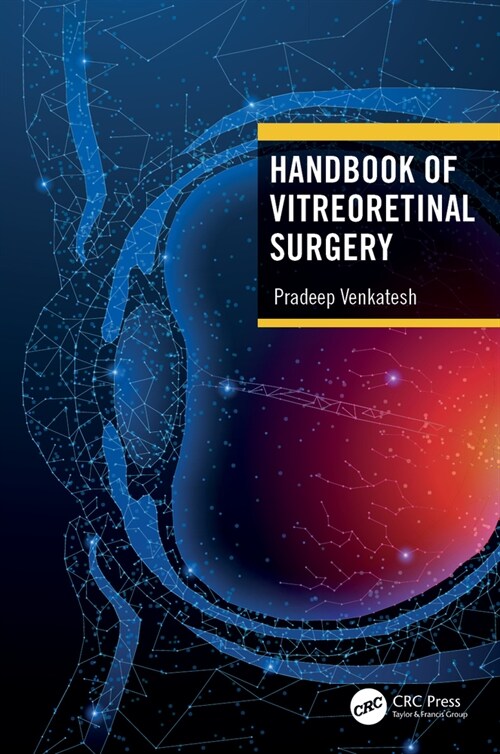 Handbook of Vitreoretinal Surgery (Hardcover, 1)