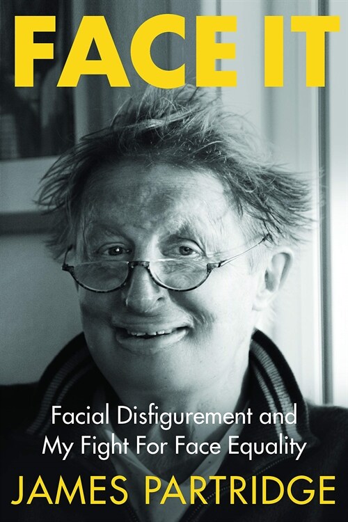 Face It : Facial Disfigurement and My Fight For Face Equality (Paperback)