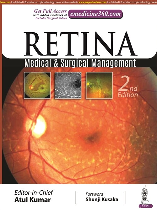 Retina : Medical & Surgical Management (Paperback, 2 Revised edition)