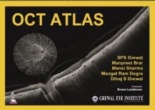 OCT Atlas (Hardcover)