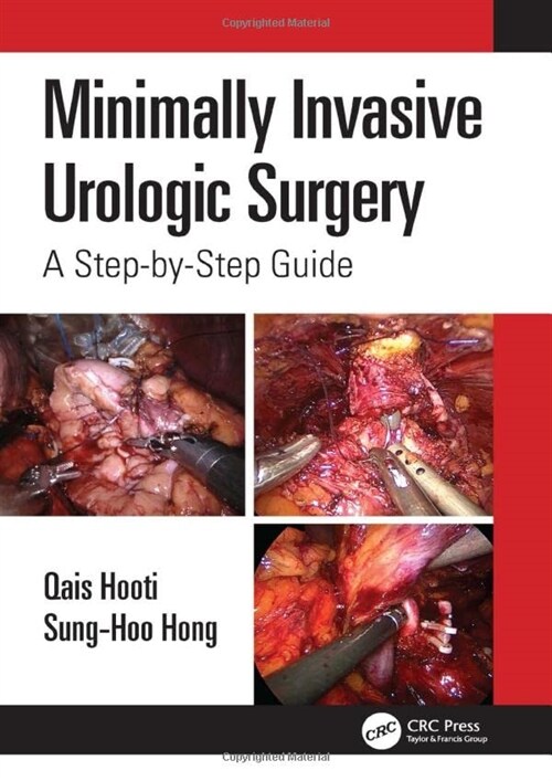 Minimally Invasive Urologic Surgery : A Step-by-Step Guide (Hardcover)