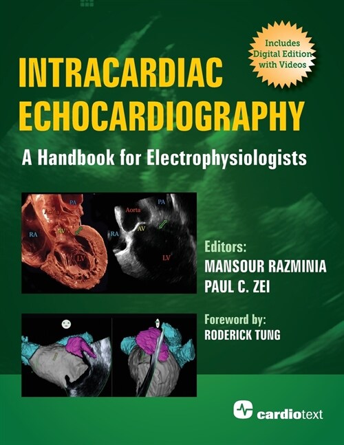 Intracardiac Echocardiography: A Handbook for Electrophysiologists (Paperback)