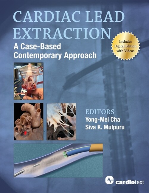 Cardiac Lead Extraction: A Case-Based Contemporary Approach (Paperback)