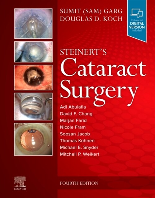 Steinerts Cataract Surgery (Hardcover, 4)